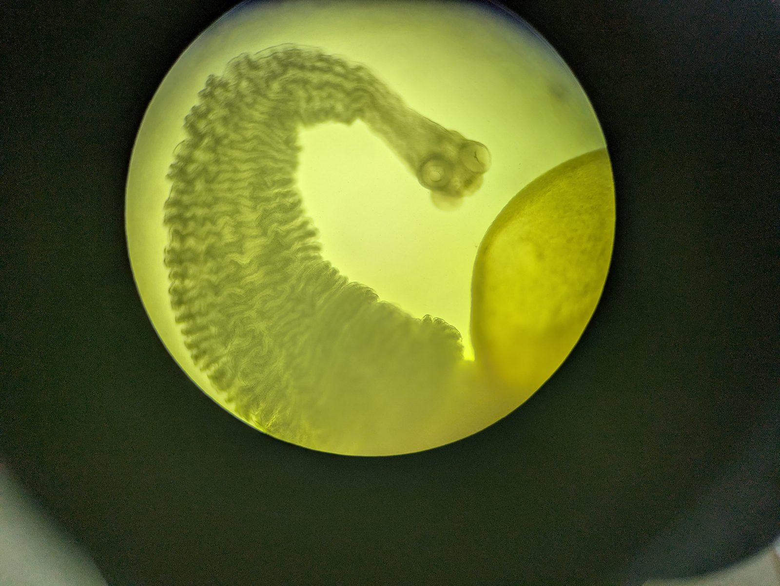 A parasite viewed under the microscope during laboratory diagnostics.